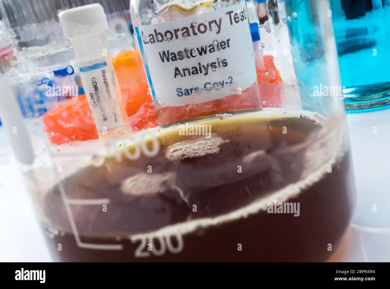 Campioni di acque reflue, analisi del virus sars-cov-2 in pazienti infettati da coronavirus umano 229E, immagine concettuale Foto Stock