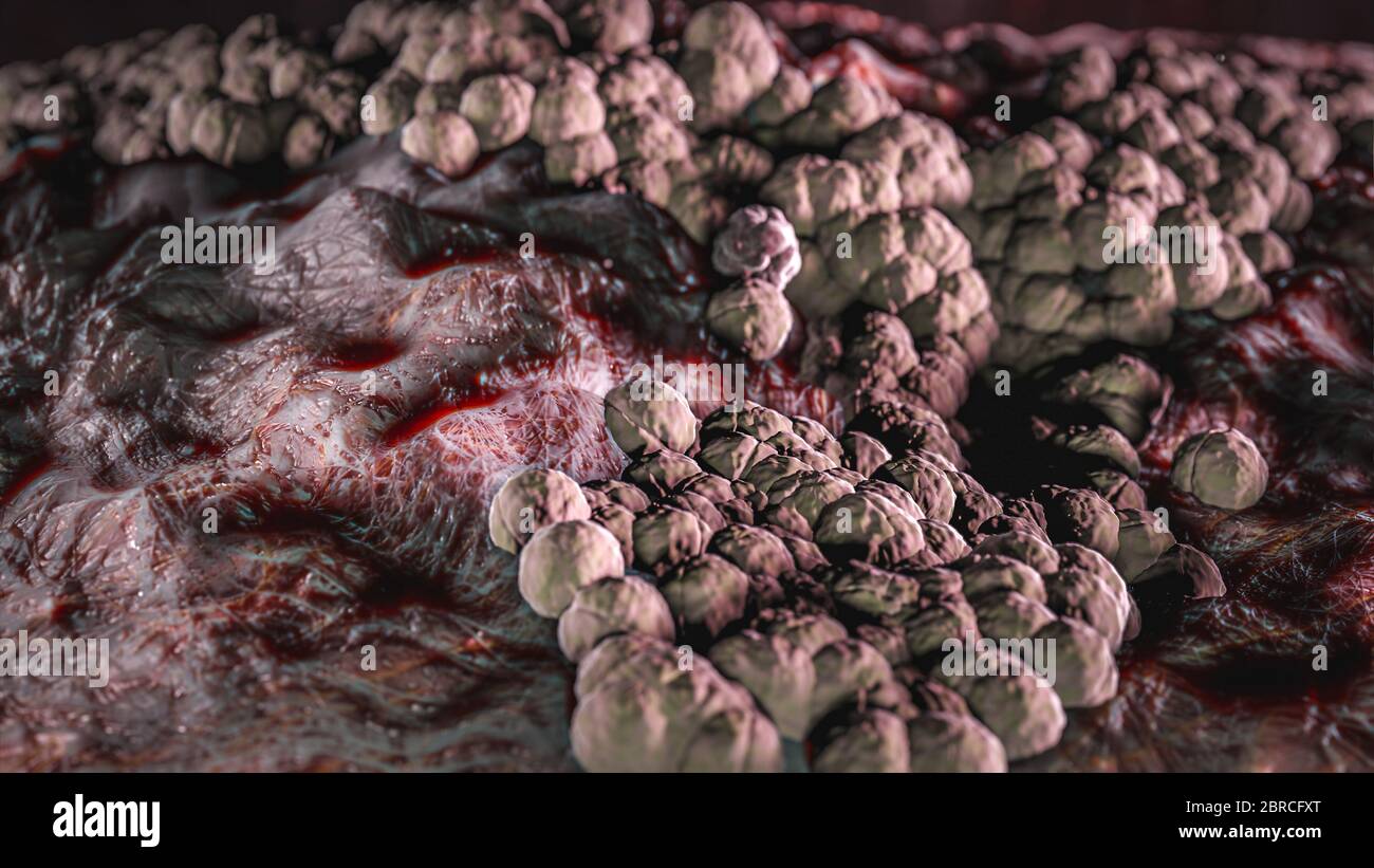 Scienza Foto di batteri Candida albicans è un lievito patogeno opportunistico che è un membro comune della flora intestinale umana Foto Stock Scienza Foto di batteri Candida albicans è un lievito patogeno opportunistico che è un membro comune della flora intestinale umana Foto Stock