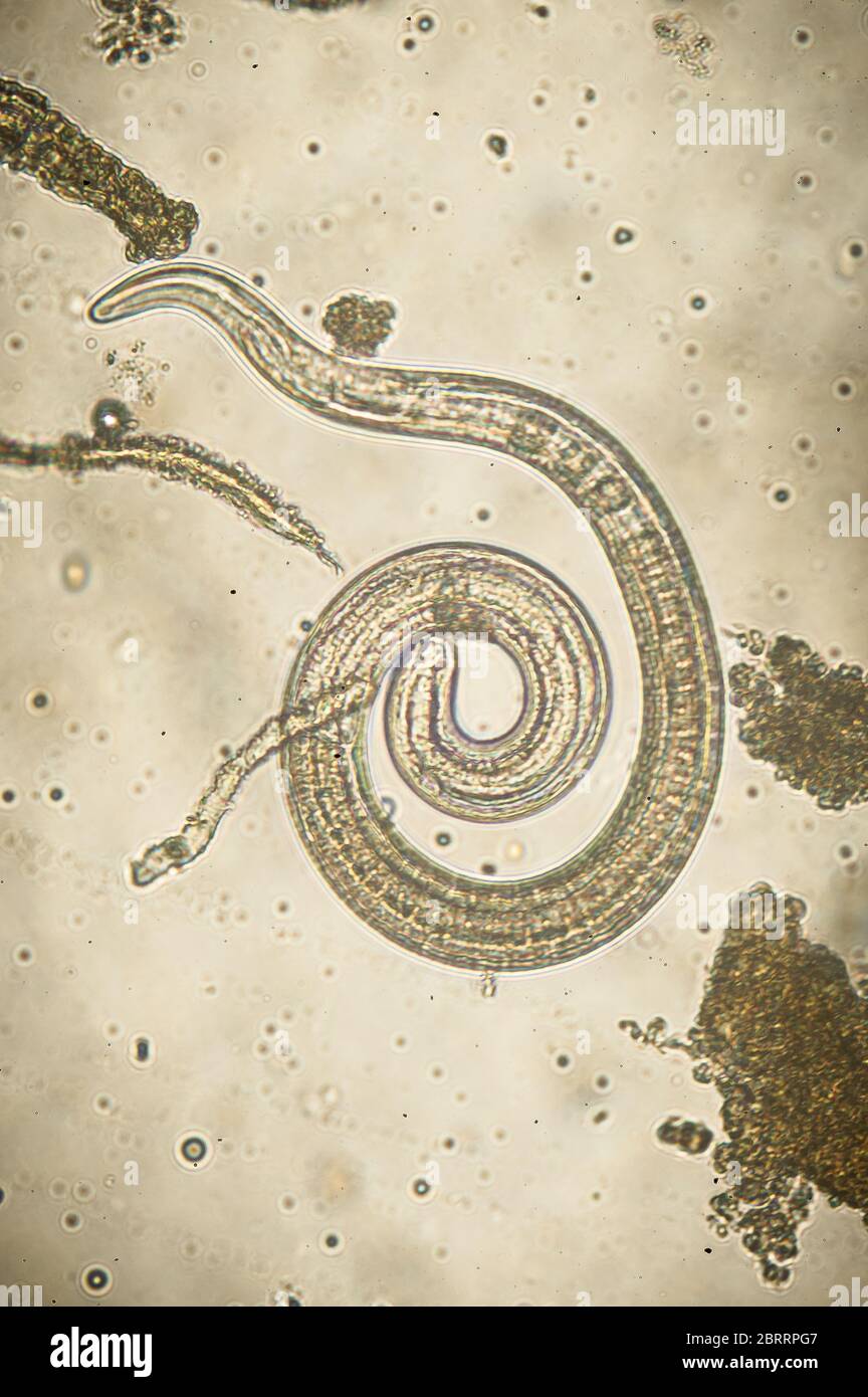 Trichinella spiralis - microscopio parassita nematoda worm Foto Stock