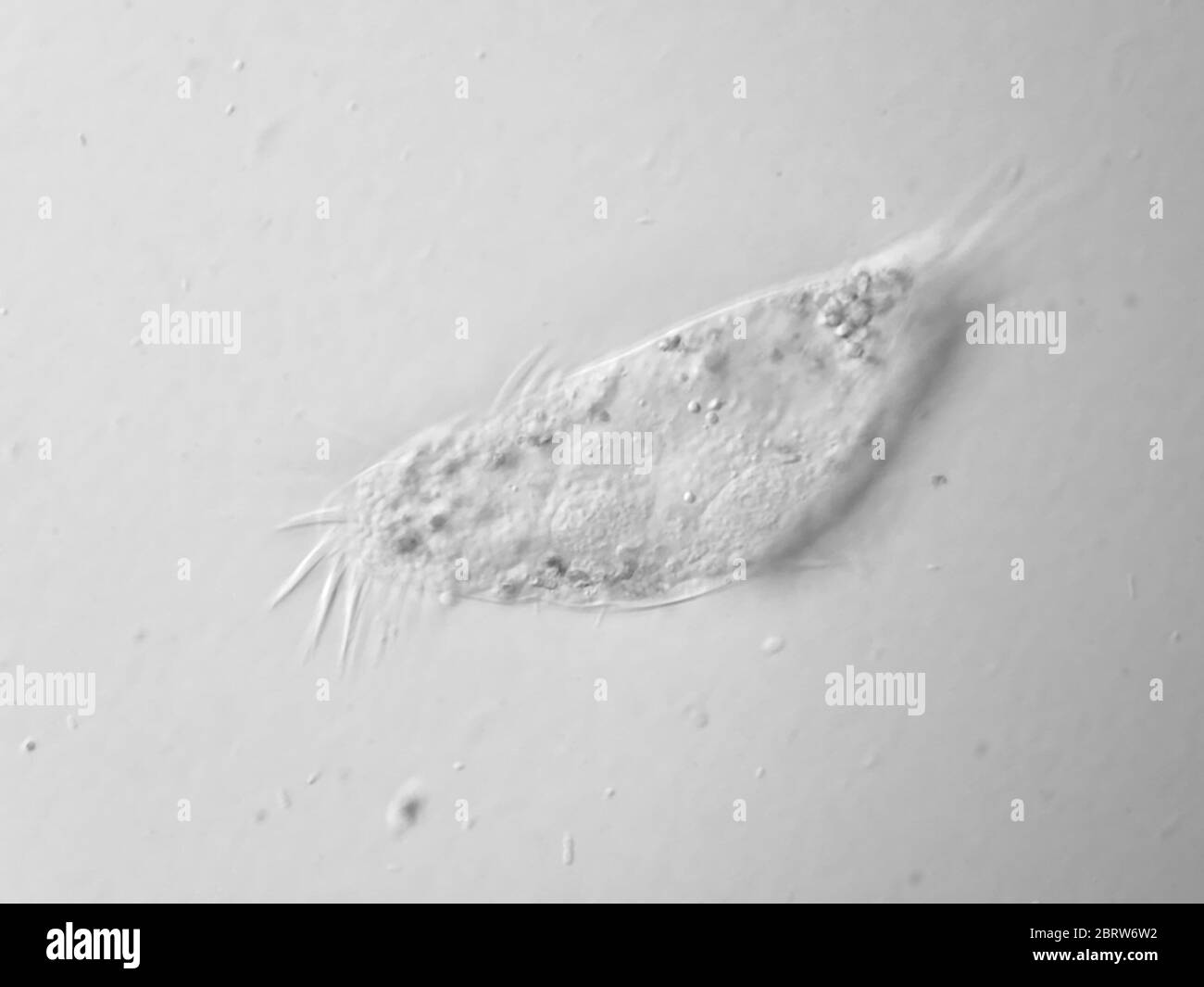 Un ciliato da un campione d'acqua al microscopio, campo visivo di circa 121 micron di larghezza Foto Stock