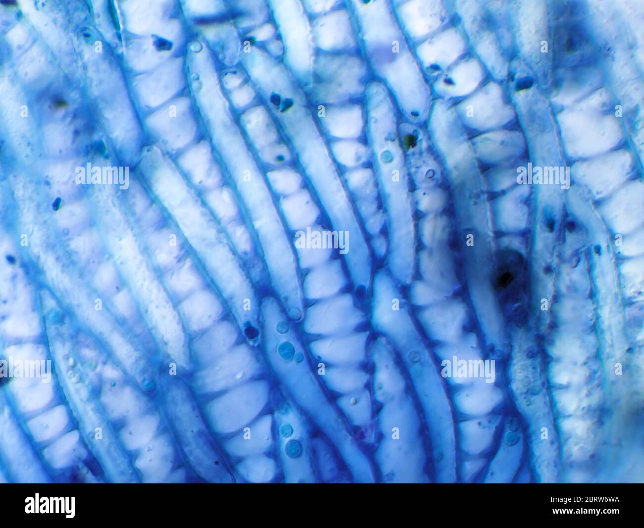 Materiale vegetale (macchiato) da un campione d'acqua del giardino, probabilmente muschio di sfinglio, sotto il microscopio; campo di vista è largo circa 1.2mm Foto Stock