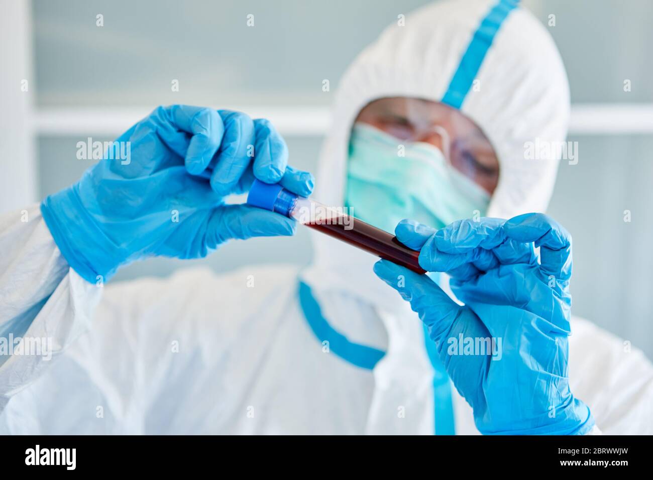 Scienziato in laboratorio studia il campionamento del sangue durante la pandemia di Coronavirus e Covid 19 Foto Stock