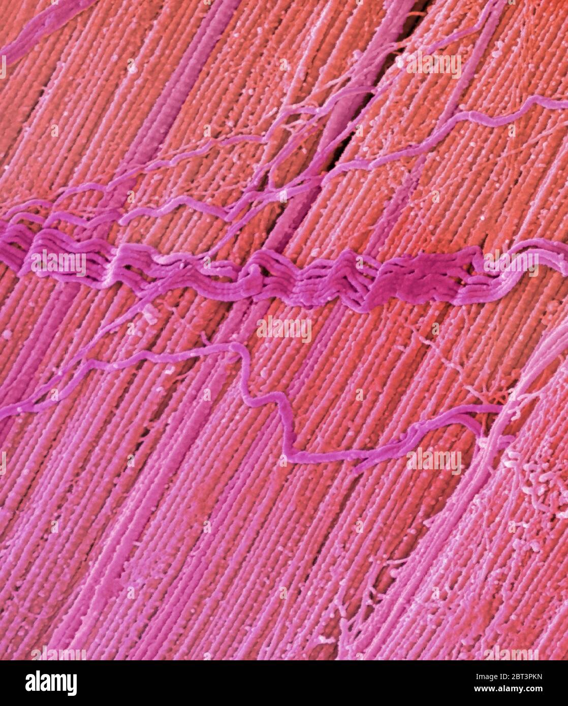 Tendine, micrografia elettronica a scansione colorata (SEM), che mostra fasci di fibre di collagene. L'allineamento parallelo delle fibre rende i tendini inelastici ma flessibili. I tendini attaccano il muscolo all'osso. Ingrandimento: x5000 se stampato con larghezza di 10 centimetri Foto Stock