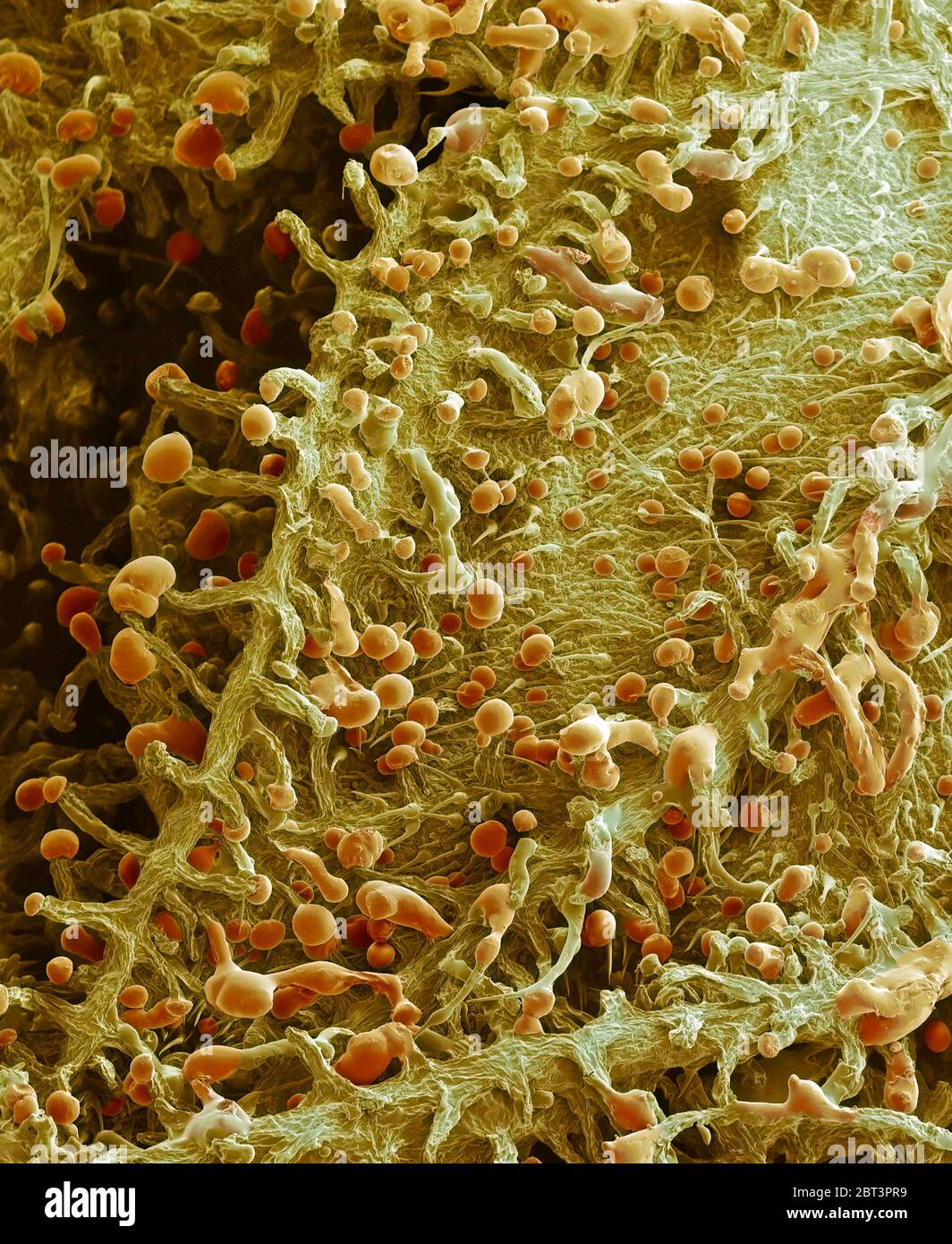 Pianta di cannabis. Micrografia elettronica a scansione colorata (SEM) della superficie di una pianta di cannabis (Cannabis sativa). I peli appuntiti sono chiamati cellule litociste. Contengono cistoliti (cristalli di carbonato di calcio). Sono presenti anche cellule ghiandolari chiamate tricomi. Questi sono tricomati capitati che hanno stalks. Queste tricomie secernono una resina (arancione) contenente tetraidrocannabinolo, il componente attivo della cannabis quando viene usato come farmaco. Ingrandimento: 220X se stampato largo 10 cm Foto Stock