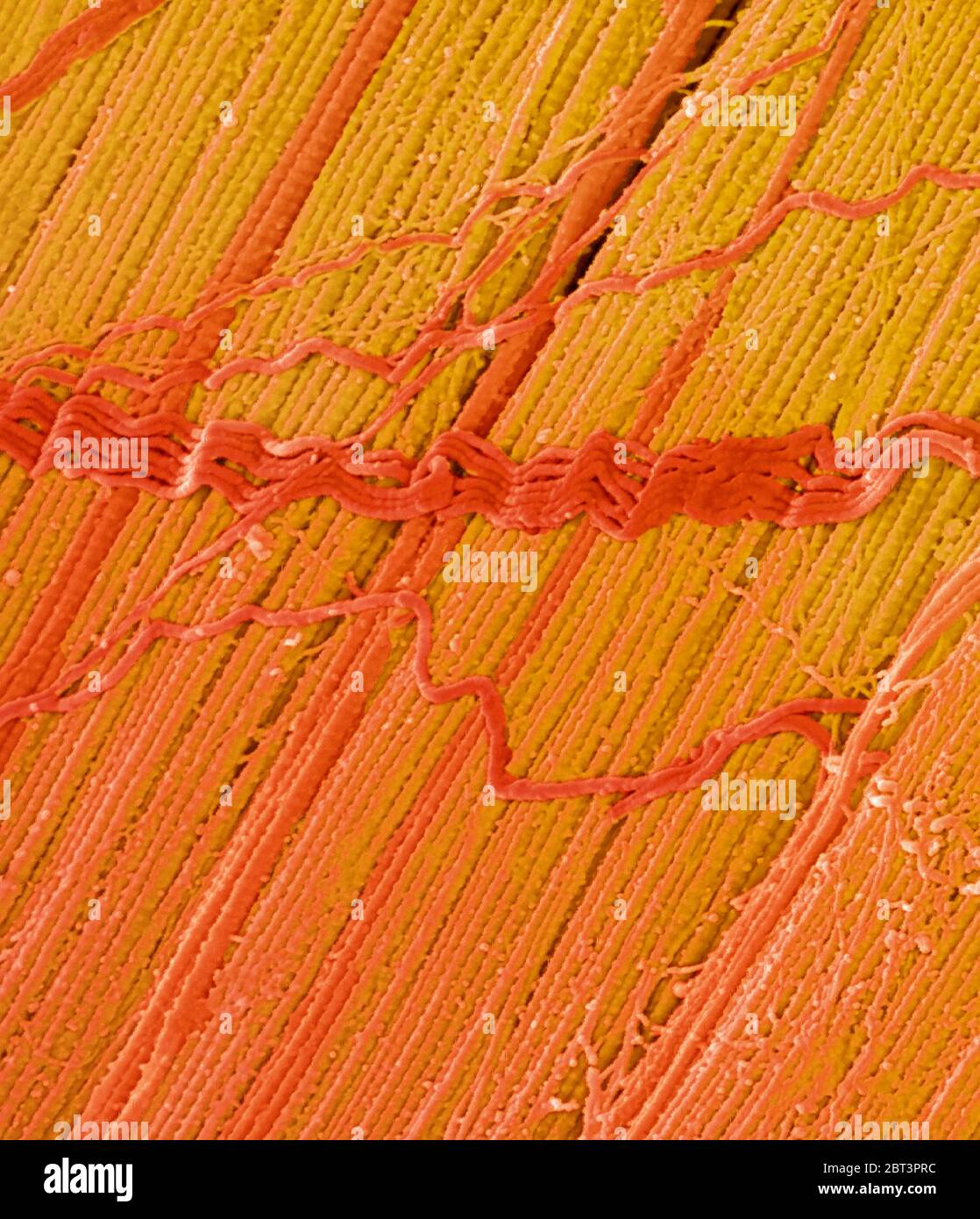Tendine, micrografia elettronica a scansione colorata (SEM), che mostra fasci di fibre di collagene. L'allineamento parallelo delle fibre rende i tendini inelastici ma flessibili. I tendini attaccano il muscolo all'osso. Ingrandimento: x5000 se stampato con larghezza di 10 centimetri Foto Stock