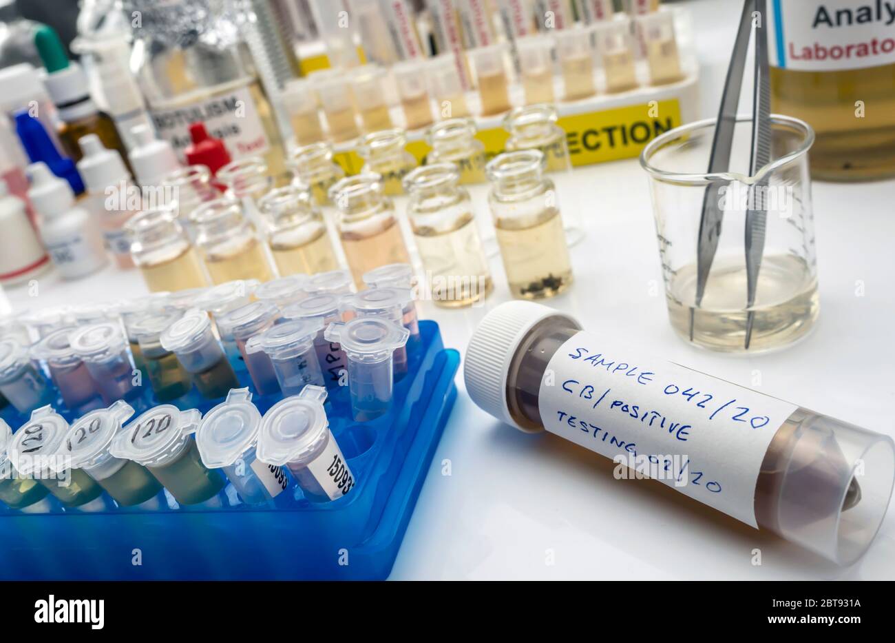 Campioni contaminati dalla tossina botulinica Clostridium che causa botulismo nell'uomo, ricerca di laboratorio, immagine concettuale Foto Stock