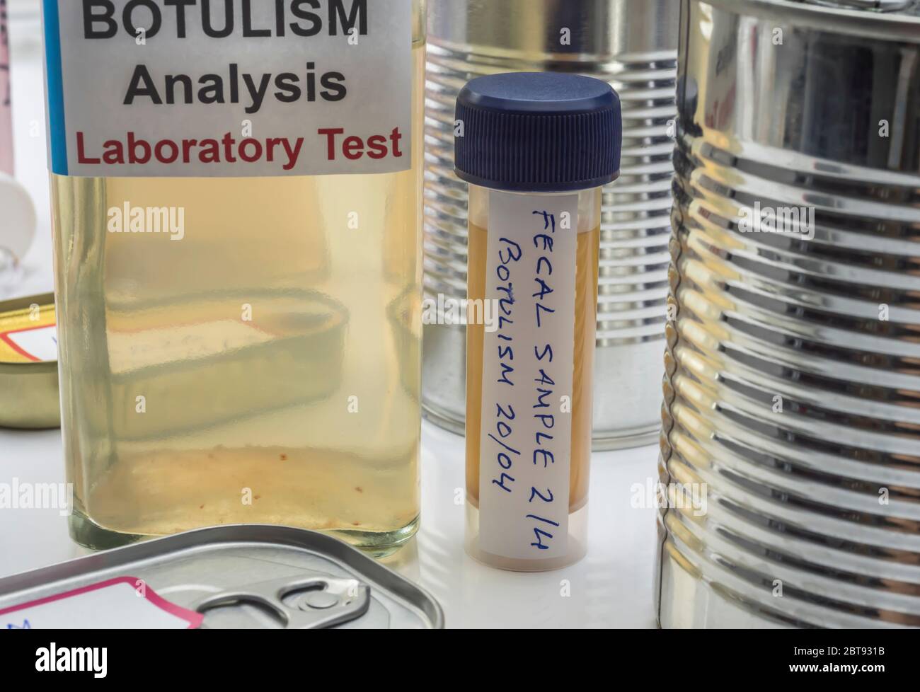 Campioni contaminati dalla tossina botulinica Clostridium che causa botulismo nell'uomo, ricerca di laboratorio, immagine concettuale Foto Stock