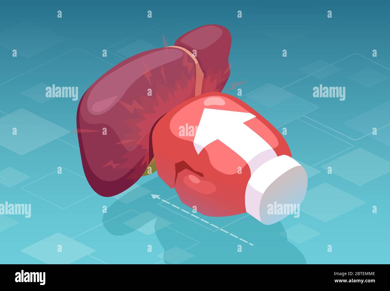 Vettore di un guanto di boxe che pugni un fegato umano. Concetto di dolore e malattia epatici Illustrazione Vettoriale