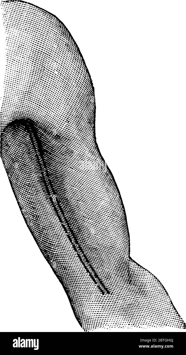 Una rappresentazione tipica dell'arteria brachiale. La linea tratteggiata nell'immagine mostra il percorso dell'arteria ramificata, il disegno di una linea vintage o l'incisione Illustrazione Vettoriale