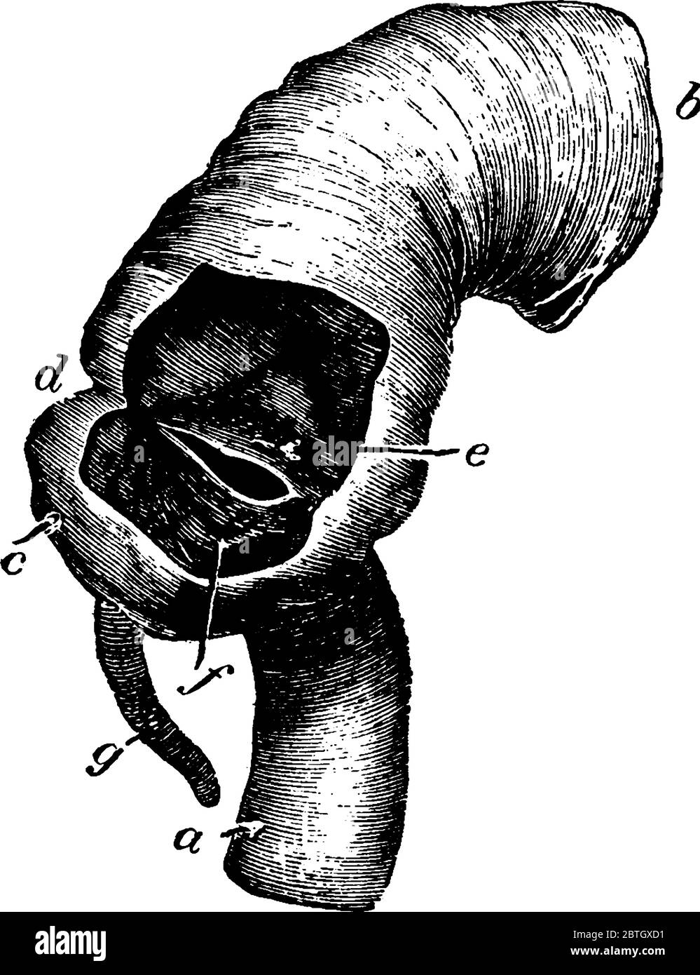 La valvola ileo-caecale, dove l'intestino tenue si unisce al grande, con le sue parti etichettate, disegno di linea vintage o illustrazione di incisione. Illustrazione Vettoriale