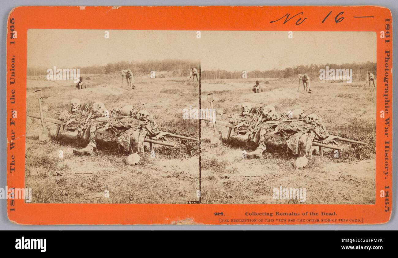 918 raccolta dei resti dei morti. Questo stereografo fotografico a stampa mostra una barella o una lettiera in primo piano con diversi resti umani scheletrici impilati su di essa. Rimane un abbigliamento sulle ossa, compreso uno scarpone che è posto sul terreno davanti alla barella con una gamba scheletrica che si estende da esso. Foto Stock
