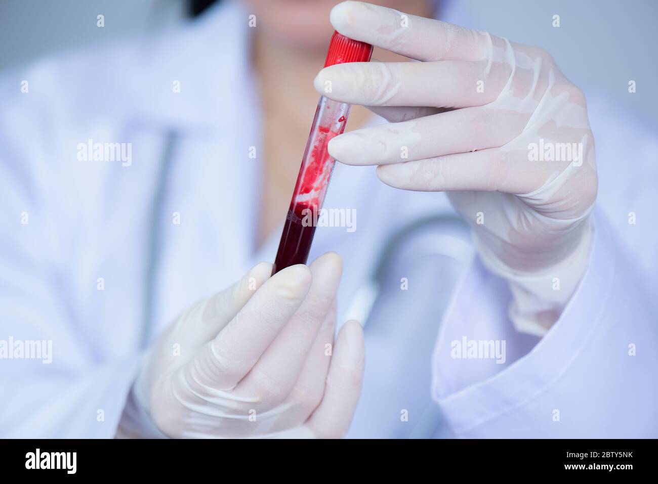 Mano di fuoco selettiva di un medico che tiene un flacone di sangue Foto Stock