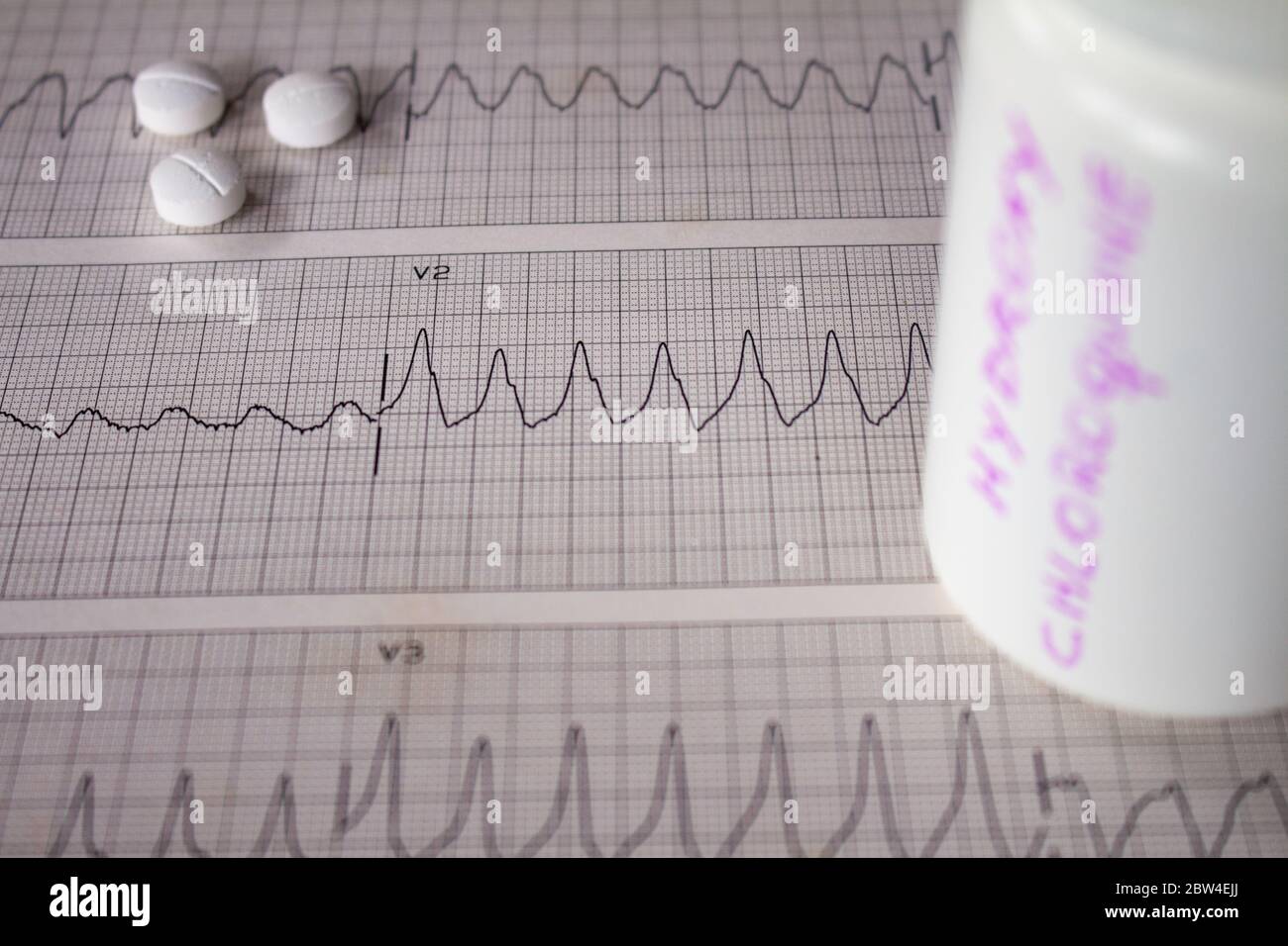 Effetti avversi sul cuore da parte di idrossiclorochina o clorochina. Pillole su un elettrocardiogramma con aritmie cardiache. Contenitore bianco con 'idro Foto Stock