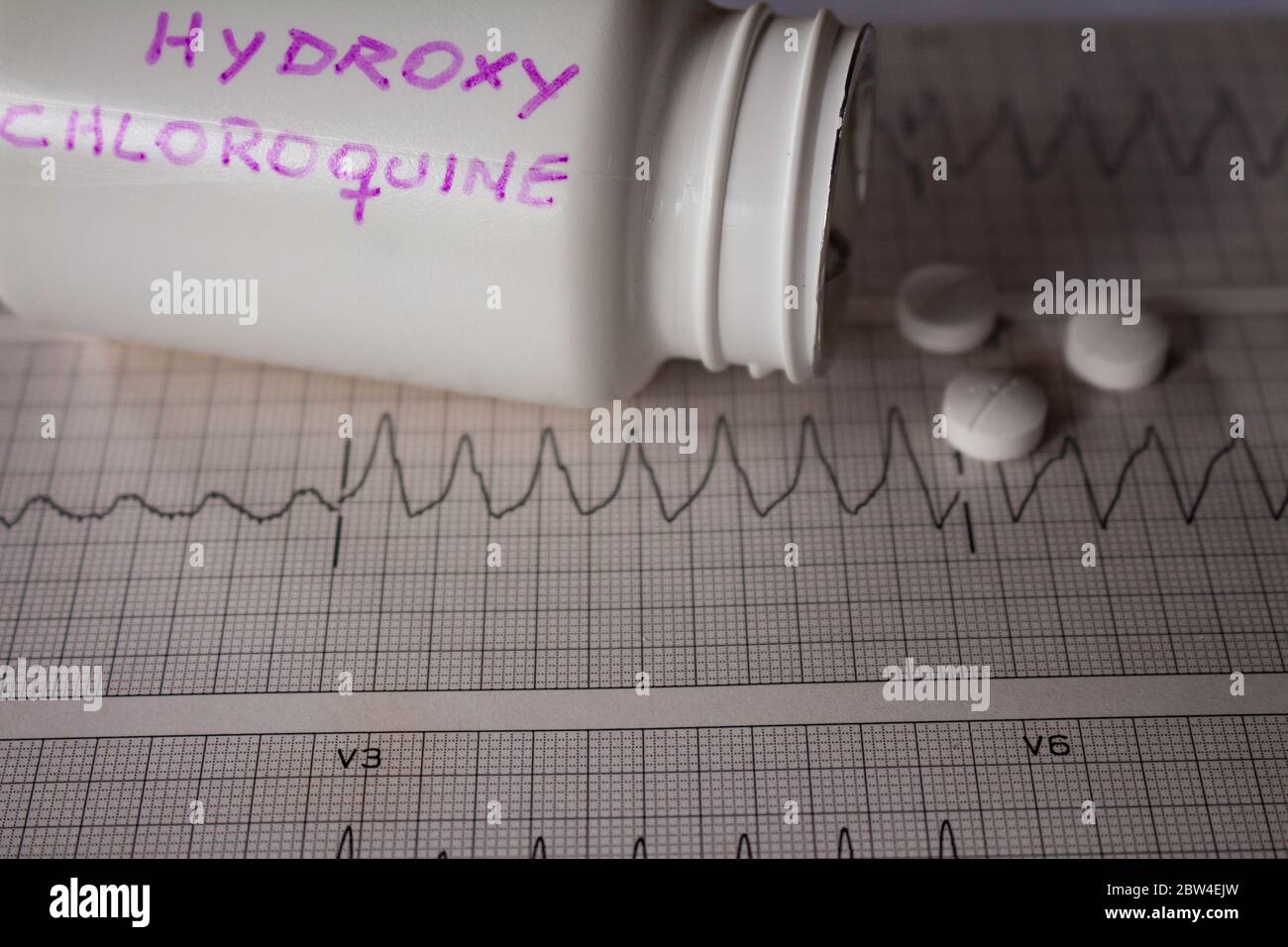 Effetti avversi sul cuore da parte di idrossiclorochina o clorochina. Pillole su un elettrocardiogramma con aritmie cardiache. Contenitore bianco con 'idro Foto Stock