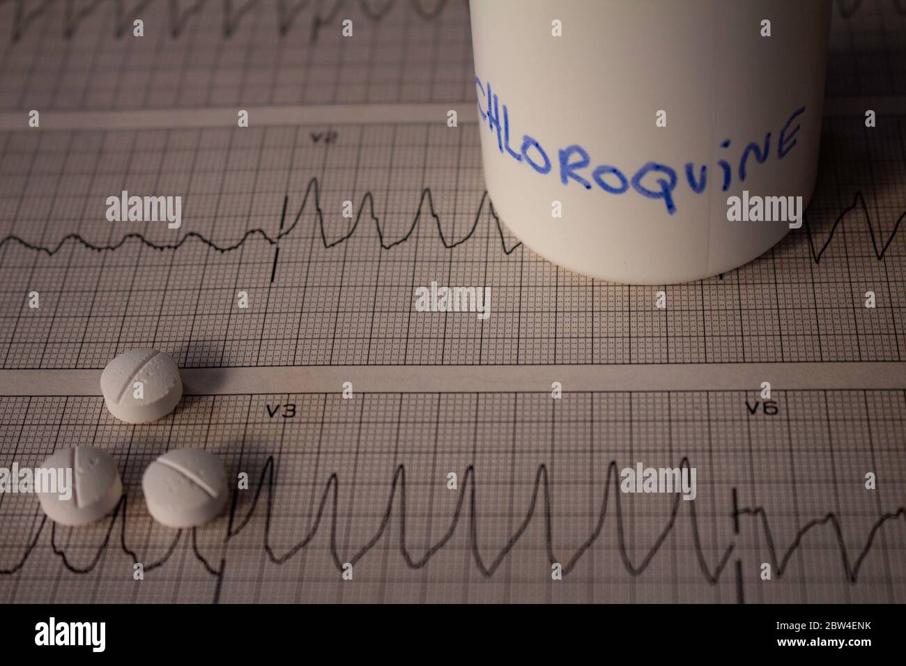 Effetti avversi sul cuore da parte di idrossiclorochina o clorochina. Pillole su un elettrocardiogramma con aritmie cardiache. Contenitore bianco con 'idro Foto Stock