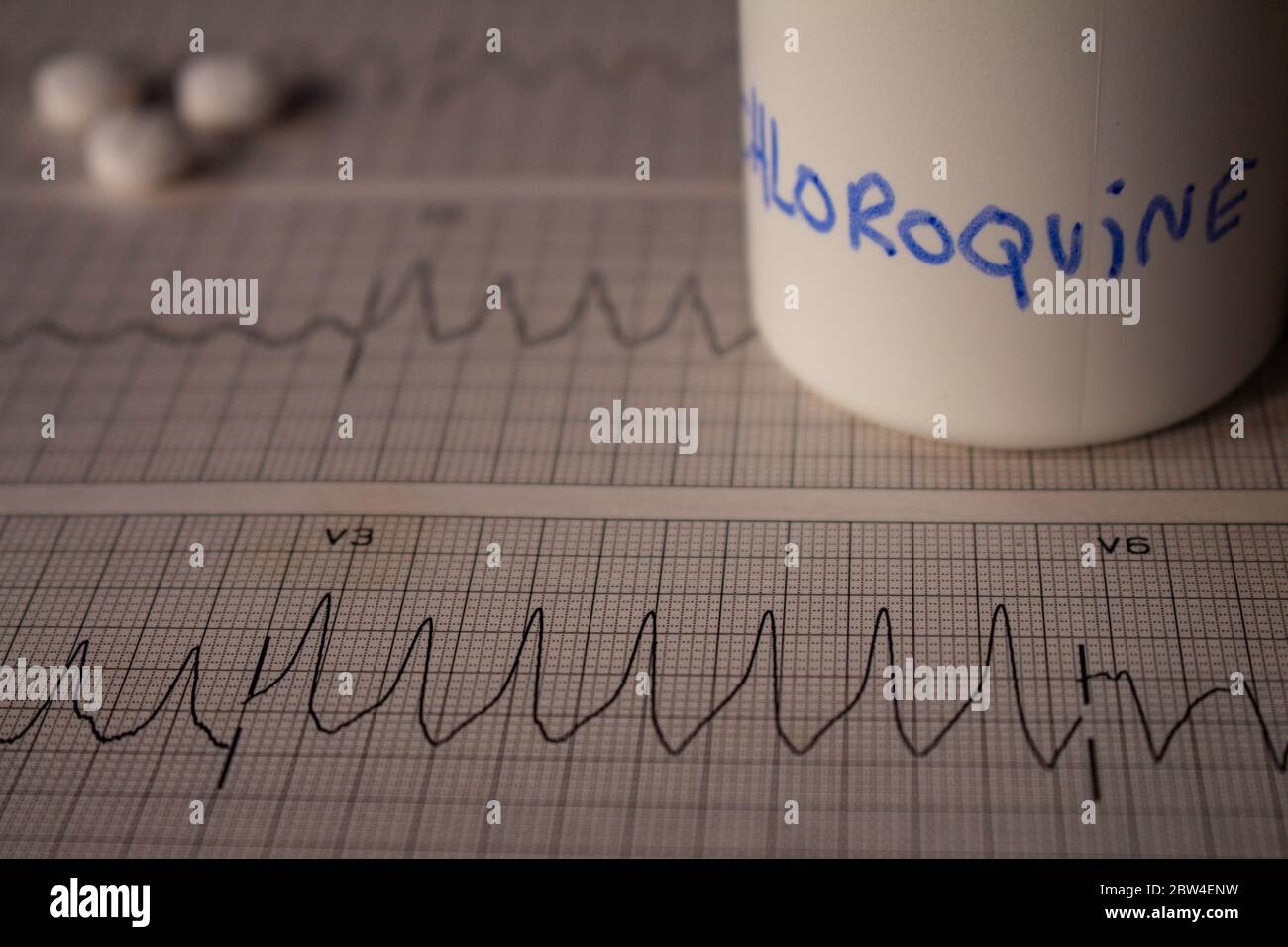 Effetti avversi sul cuore da parte di idrossiclorochina o clorochina. Pillole su un elettrocardiogramma con aritmie cardiache. Contenitore bianco con 'idro Foto Stock