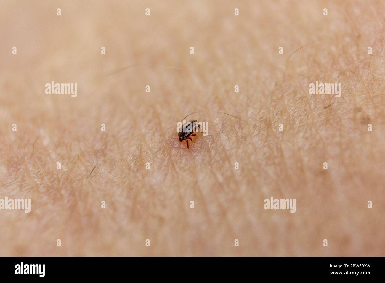 Infezione da parassiti della pelle immagini e fotografie stock ad alta risoluzione Alamy