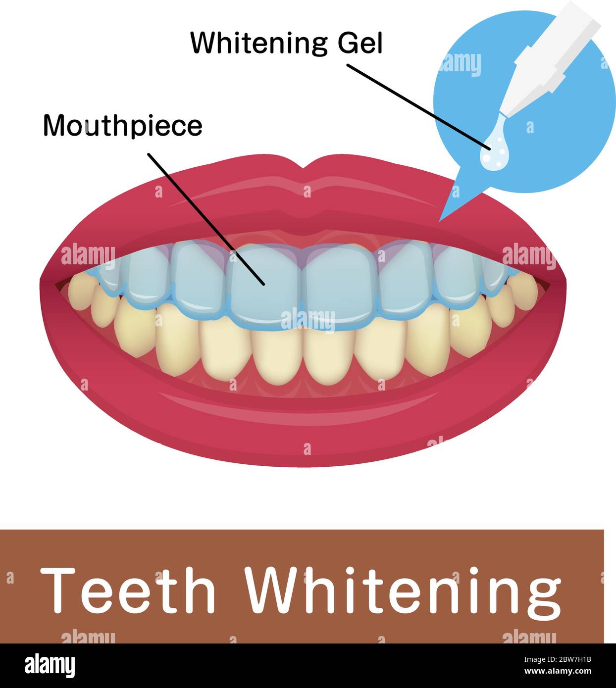 Immagine vettoriale dei denti sbiancanti a casa Illustrazione Vettoriale