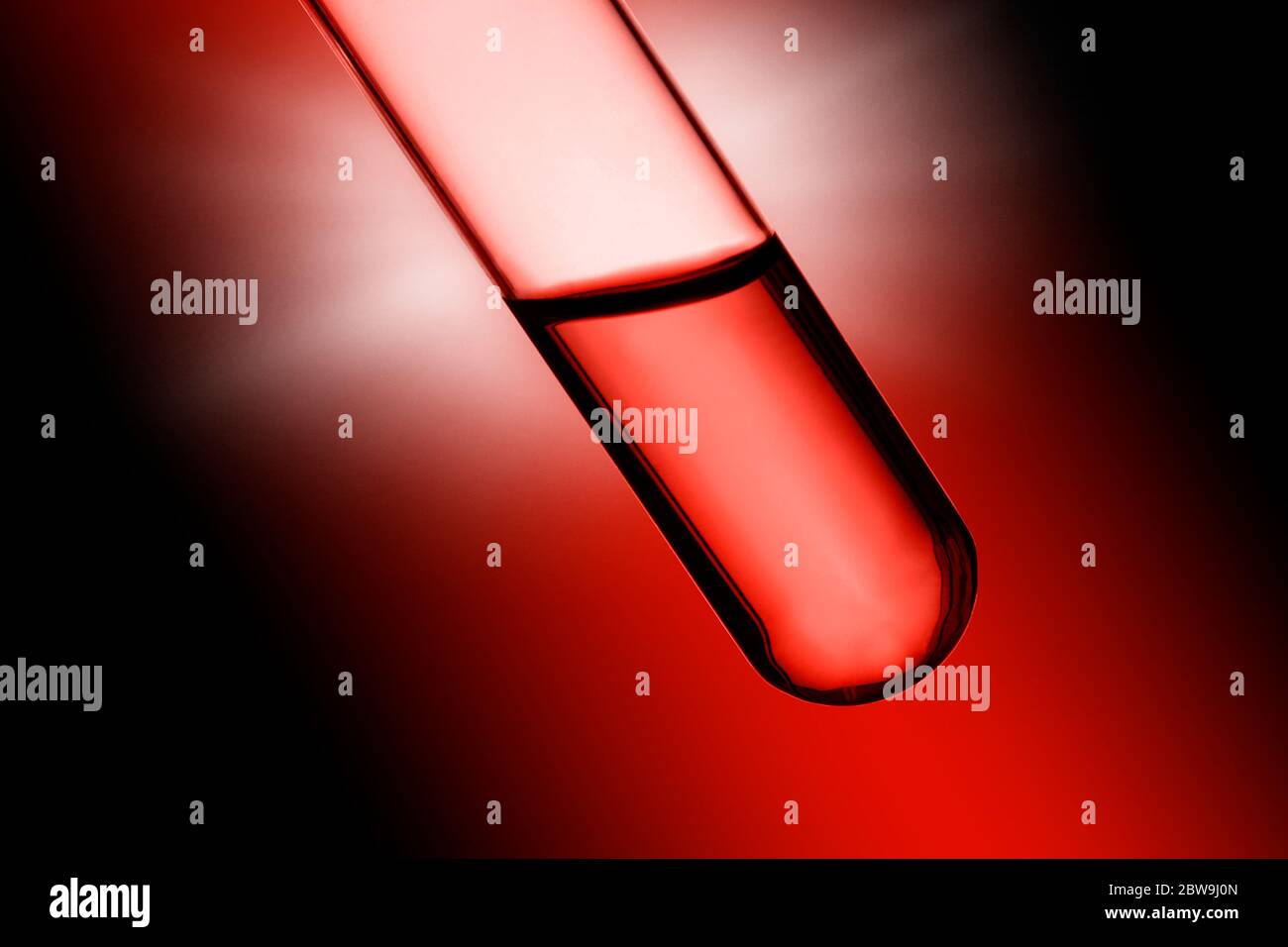 Primo piano del campione di sangue Foto Stock