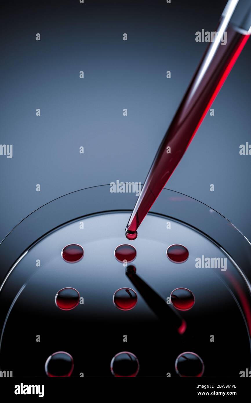 Campione di sangue testato in laboratorio su piastra Petri Foto Stock