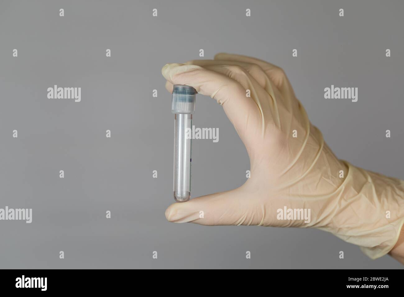 Provetta vuota per l'analisi biomateriale nelle mani di un infermiere. Analisi clinica del virus con misure precauzionali. Foto Stock