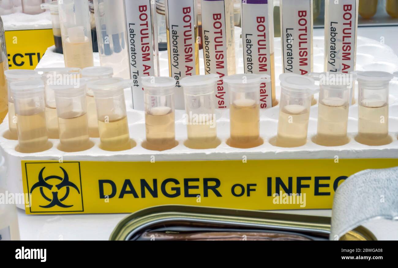 Campioni contaminati dalla tossina botulinica Clostridium che causa botulismo nell'uomo, ricerca di laboratorio, immagine concettuale Foto Stock