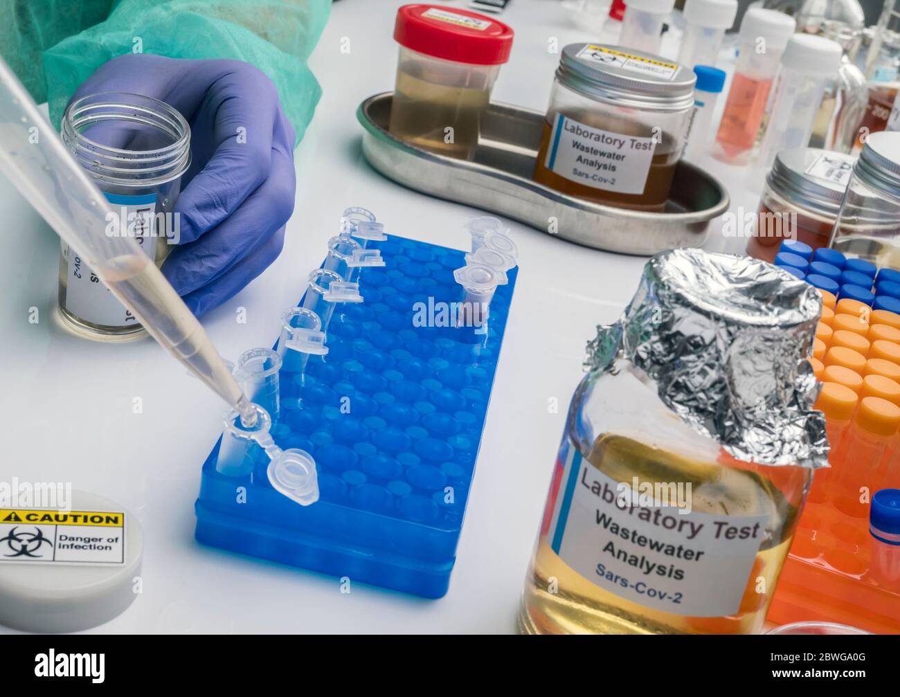 Analisi scientifica del campione di acque reflue in laboratorio, indagine di possibile contaminazione da parte di Sars-Cov-2 nell'uomo, immagine concettuale Foto Stock