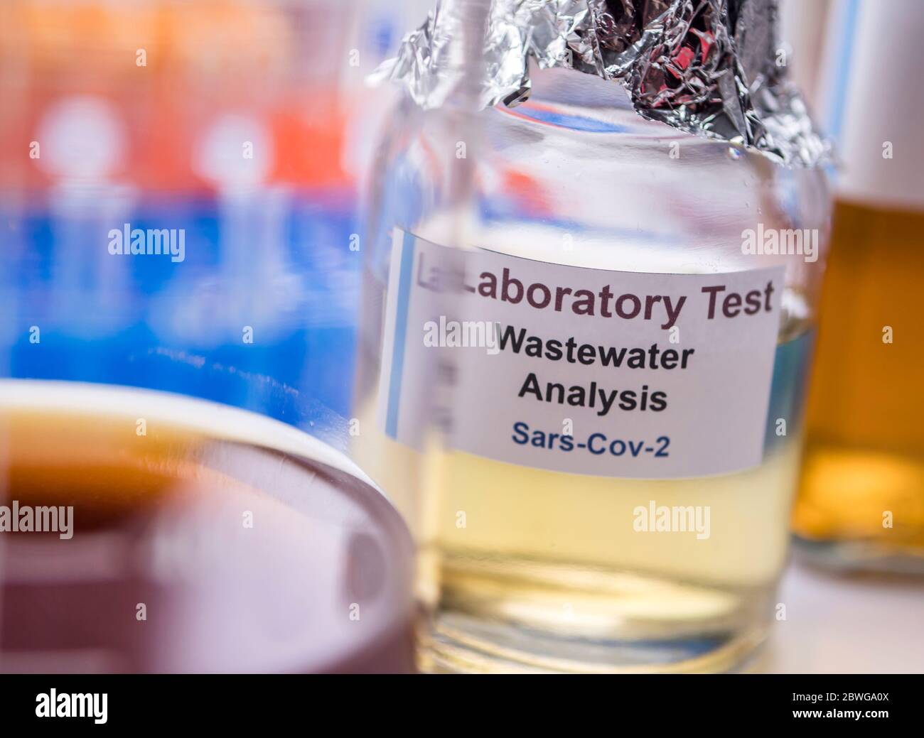 Campioni di acque reflue, analisi del virus sars-cov-2 in pazienti infettati da coronavirus umano 229E, immagine concettuale Foto Stock