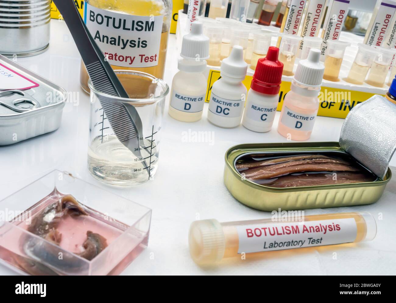 Campioni contaminati dalla tossina botulinica Clostridium che causa botulismo nell'uomo, ricerca di laboratorio, immagine concettuale Foto Stock