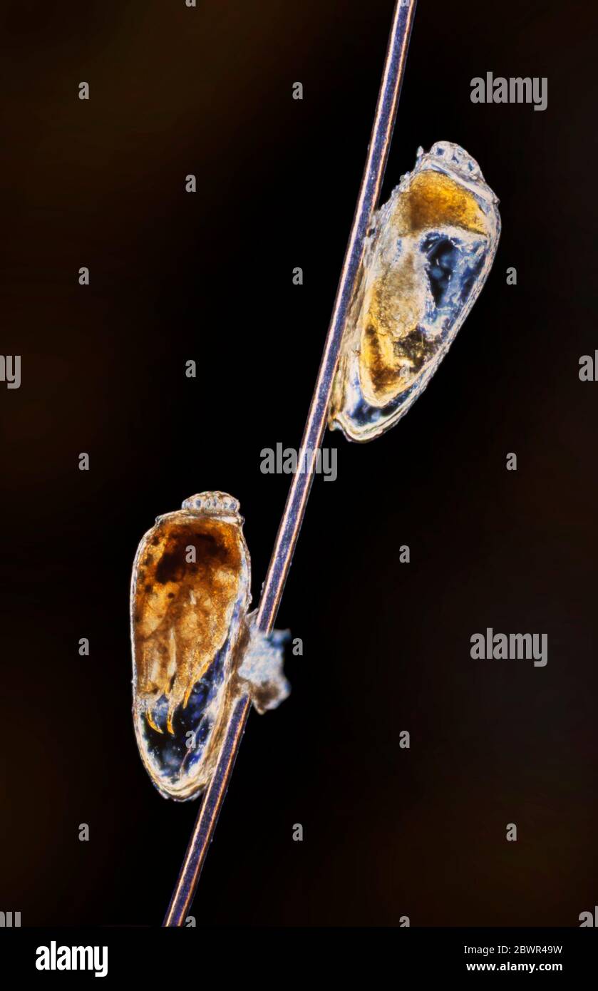 Uova di camicetta della testa umana sui capelli, Pediculus humanus, uova (nits) attaccate al ciocca di capelli umani Foto Stock