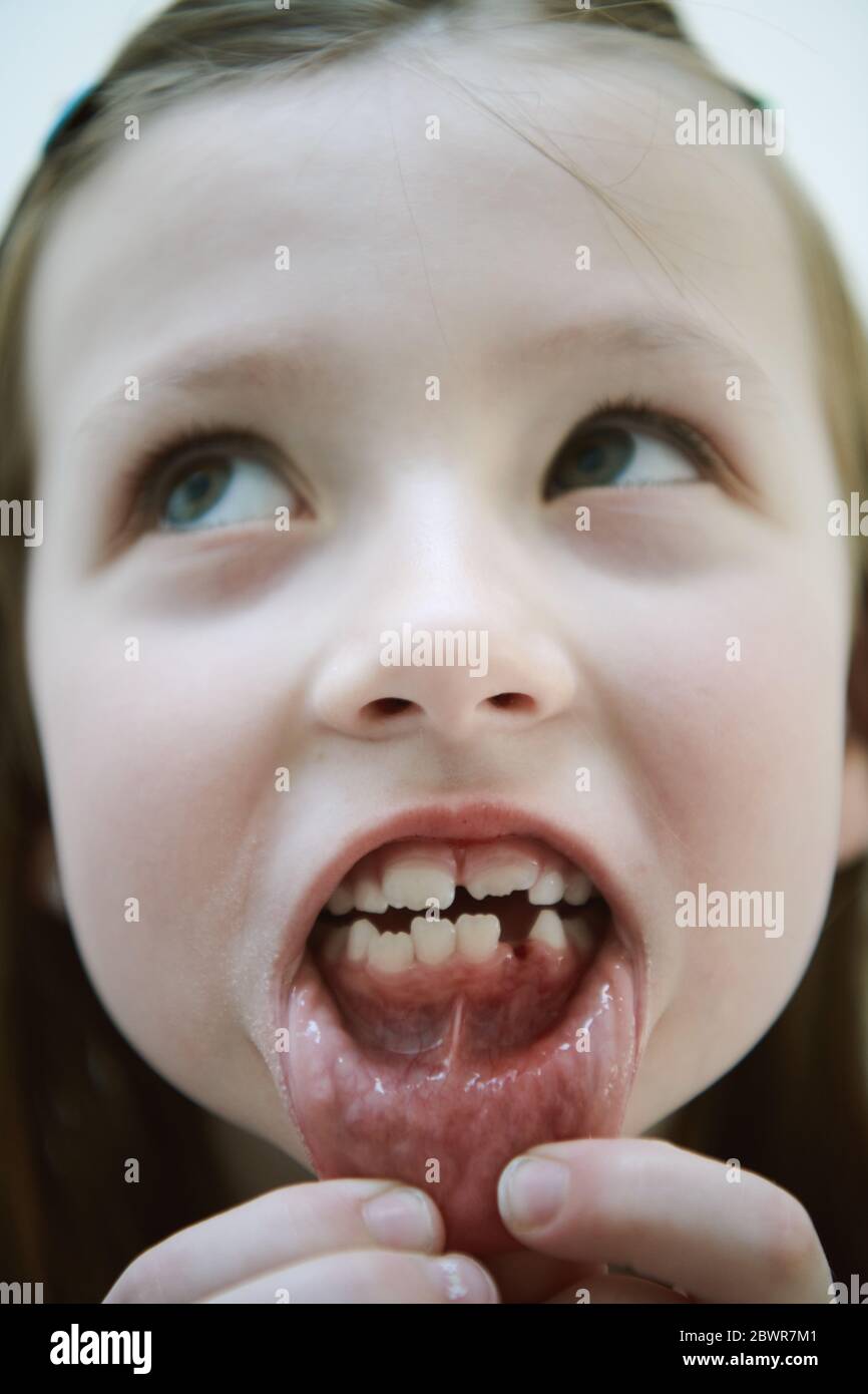 Divertente bambina senza sorrisi dentali mostrando distanza ravvicinata Foto Stock