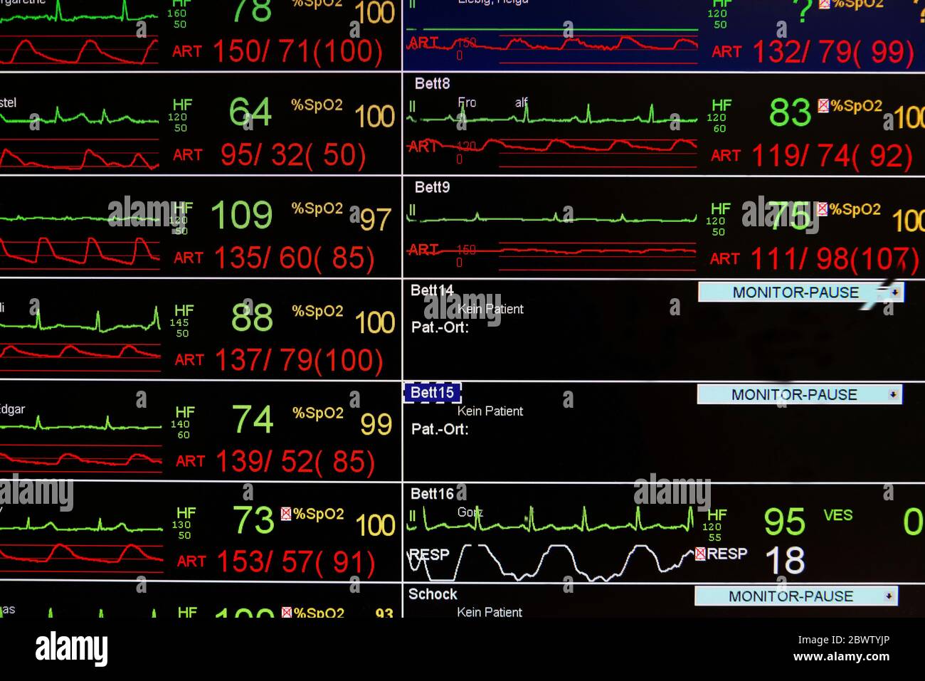 Primo piano della schermata EKG Foto Stock