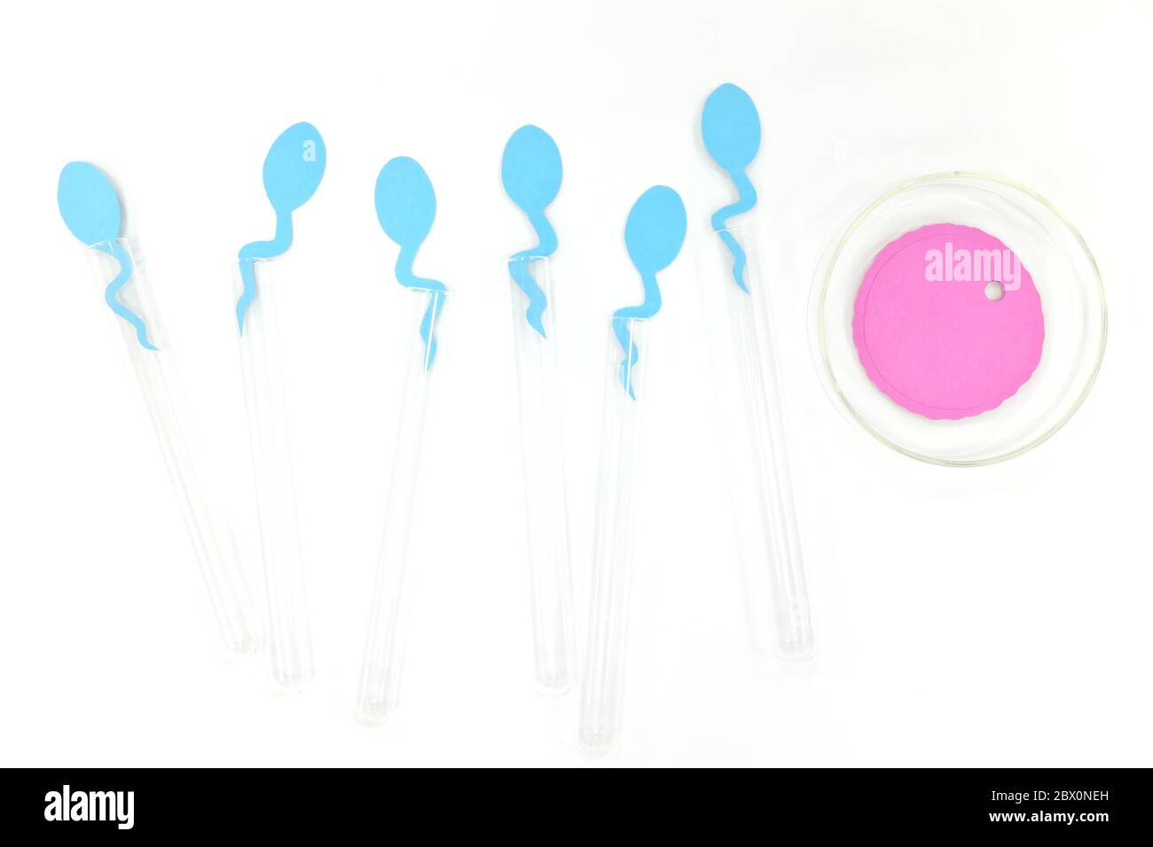 Concetto di fertilizzazione in vitro. Sperma e ovociti su provetta e capsula di Petri in laboratorio. Foto Stock