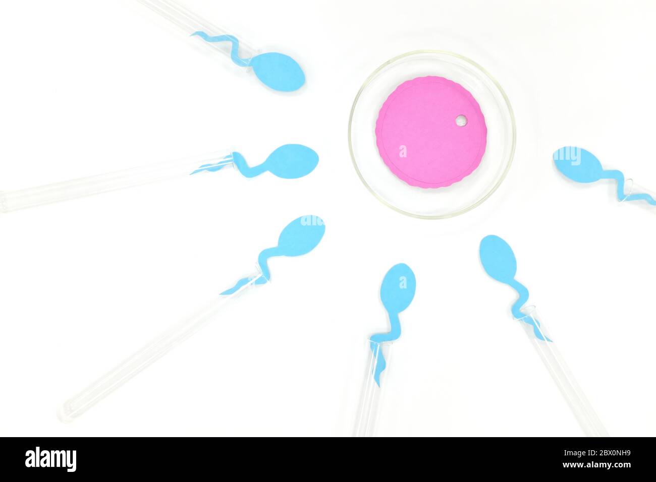 Concetto di fertilizzazione in vitro. Sperma e ovociti su provetta e capsula di Petri in laboratorio. Foto Stock