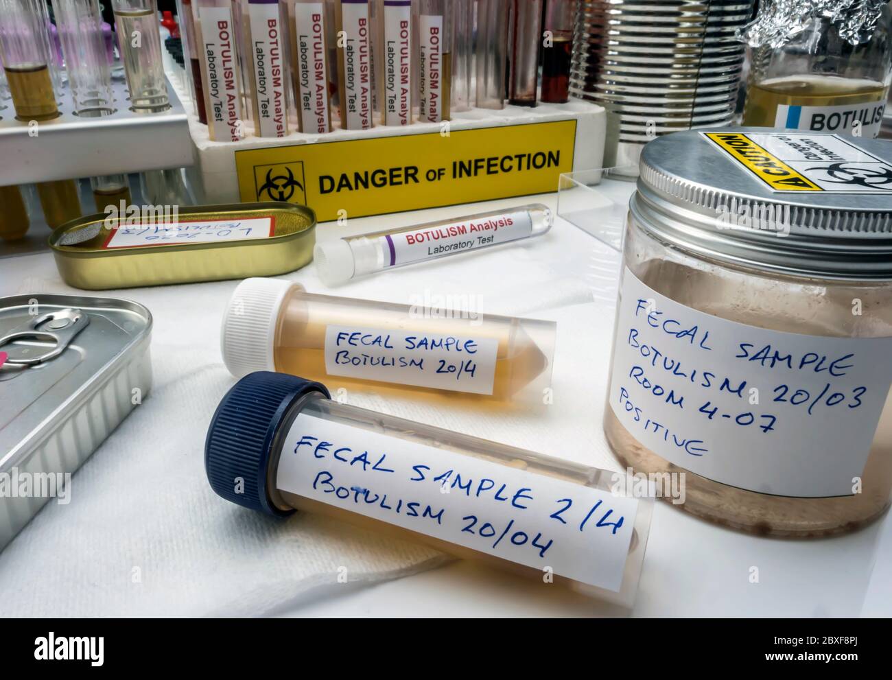 Campioni contaminati dalla tossina botulinica Clostridium che causa botulismo nell'uomo, ricerca di laboratorio, immagine concettuale Foto Stock