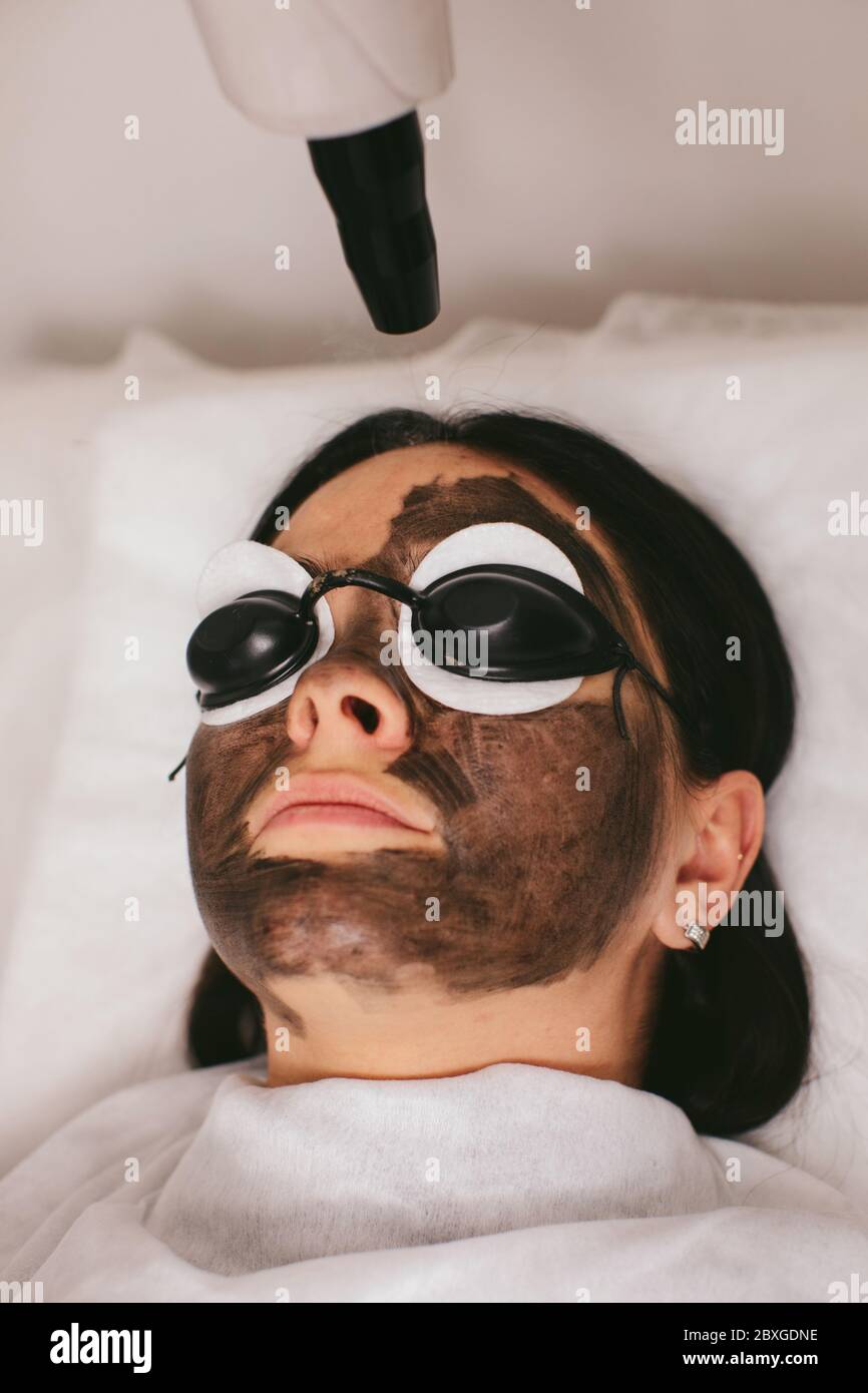 Donna che ha un trattamento di bellezza di buccia di carbonio Foto Stock