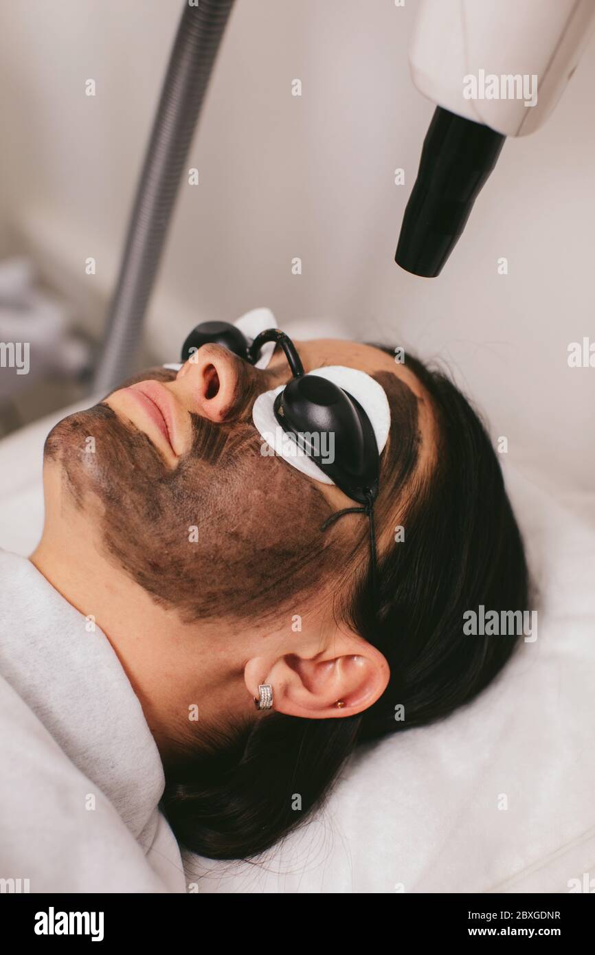 Donna che ha un trattamento di bellezza di buccia di carbonio Foto Stock