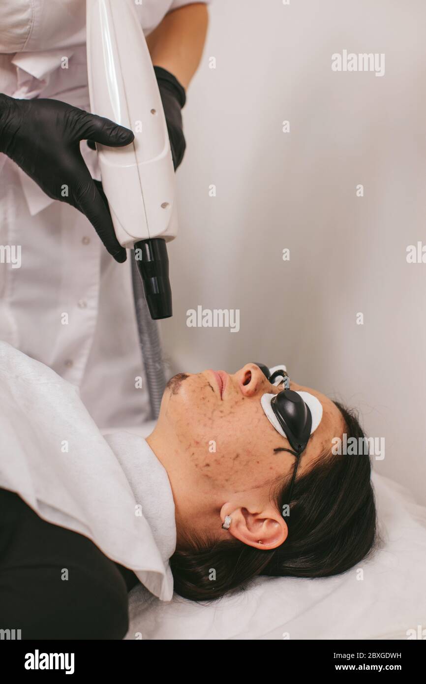 Donna che ha un trattamento di bellezza di buccia di carbonio Foto Stock