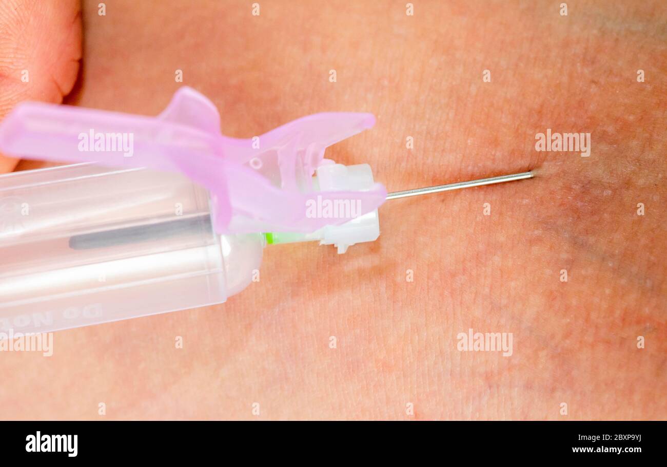 Un medico preleva un campione di sangue da un braccio del paziente Foto Stock