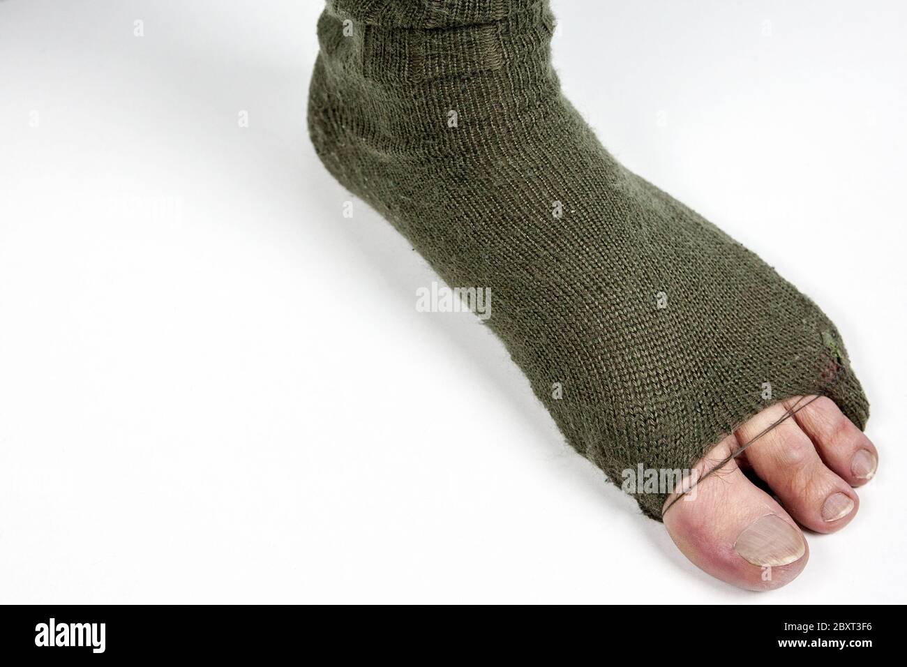 Debolezza del materiale. La punta dell'escursionista guarda fuori della lana strappata calza. Ciò non sarebbe accaduto con le calze buone di trekking. Foto Stock