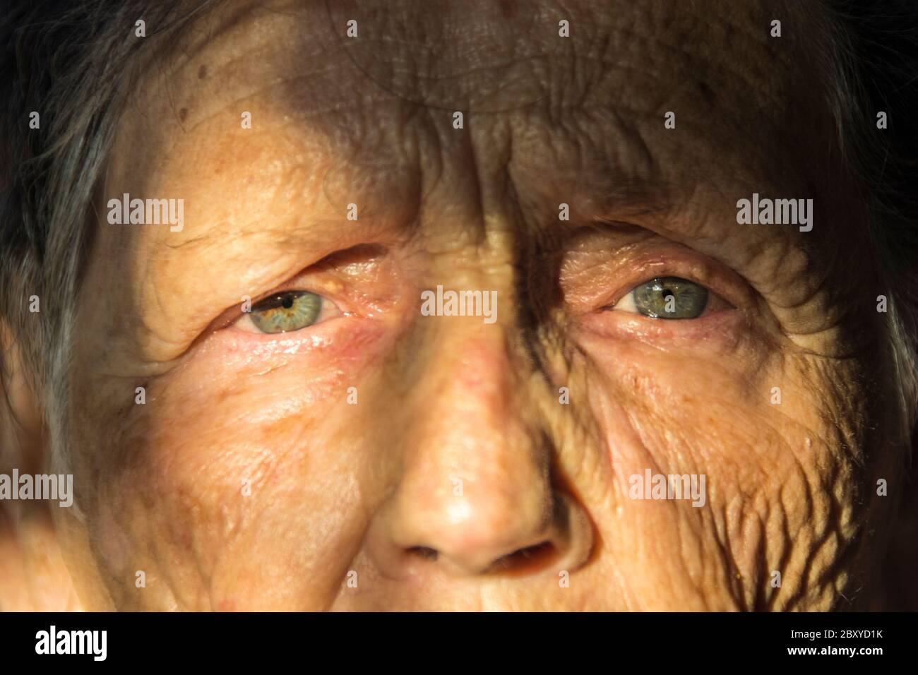 Una donna di 83 anni con una vasta gamma di problemi medici ed emotivi. Foto Stock