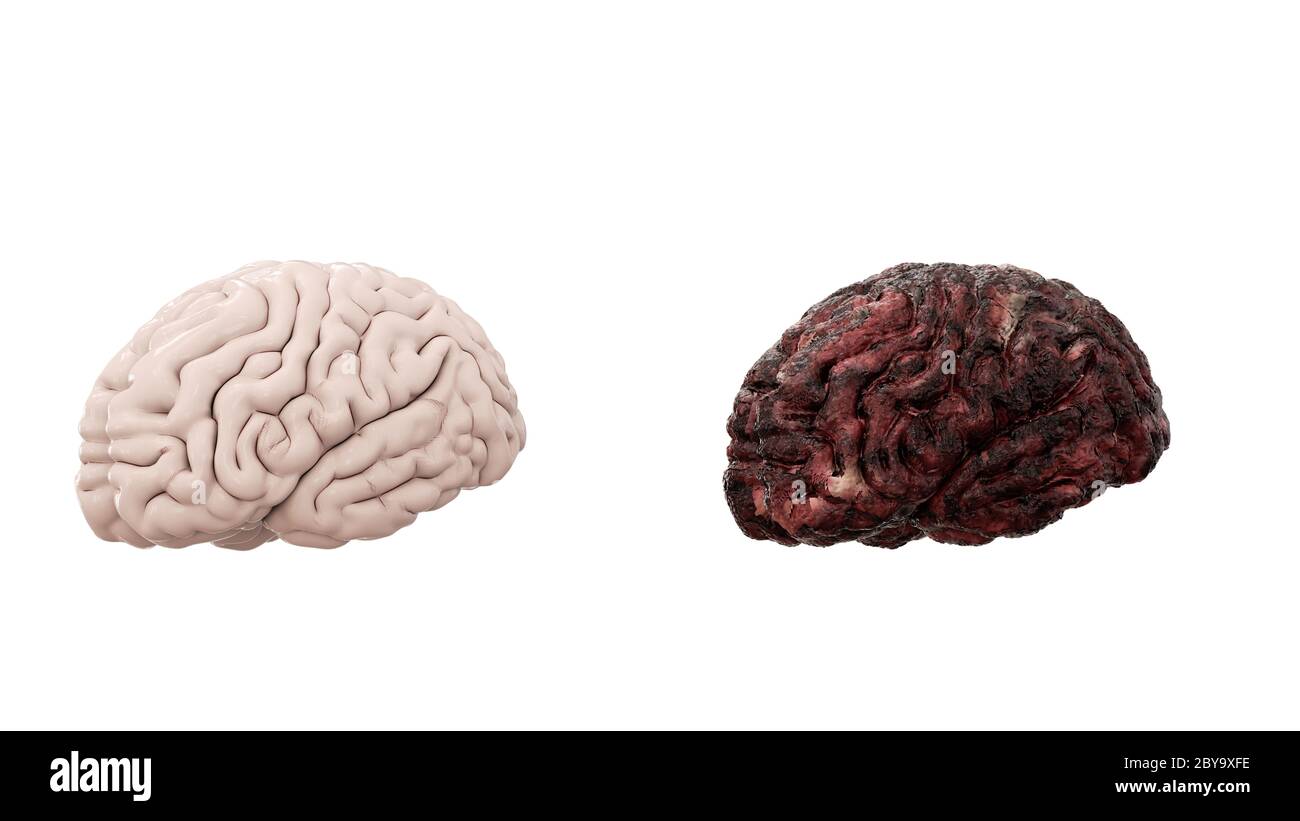 cervello sano e cervello di malattia su isolato bianco. Concetto medico autopsia. Cancro e problema di fumo. rendering 3d Foto Stock