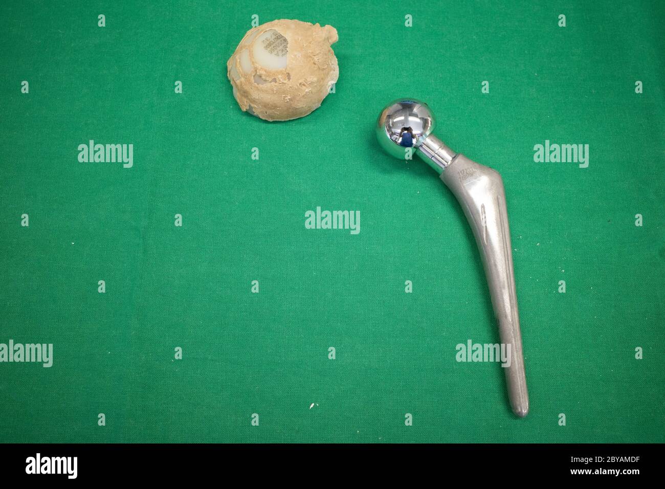 una protesi espiantata dell'anca è stata pulita e giace su un telo chirurgico verde Foto Stock