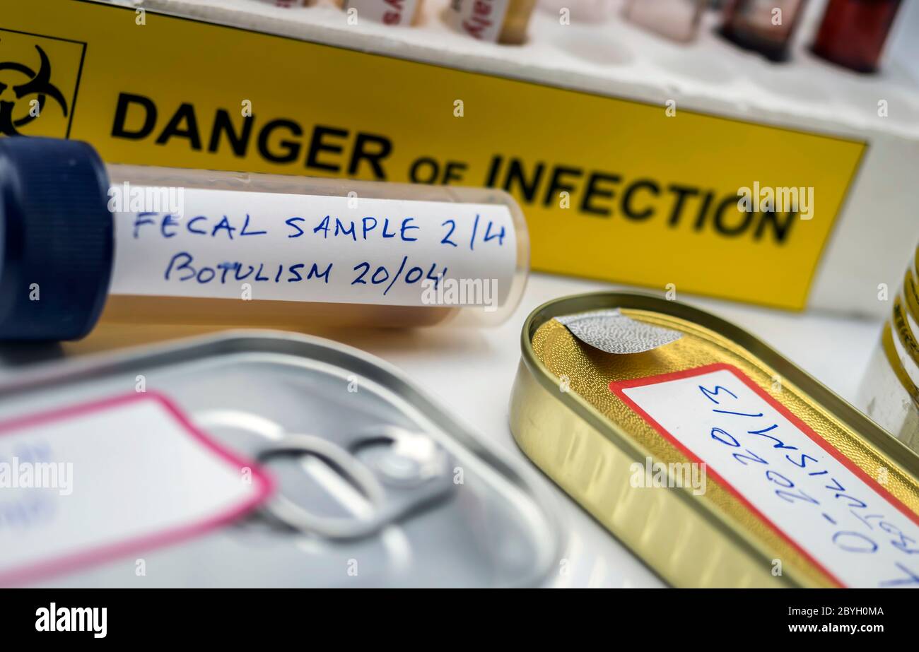 Campioni contaminati dalla tossina botulinica Clostridium che causa botulismo nell'uomo, ricerca di laboratorio, immagine concettuale Foto Stock
