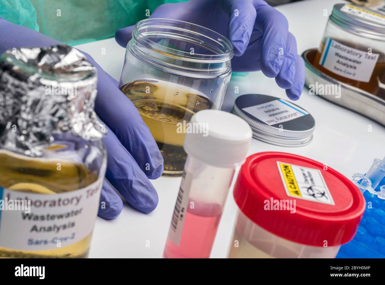 Analisi scientifica del campione di acque reflue in laboratorio, indagine di possibile contaminazione da parte di Sars-Cov-2 nell'uomo, immagine concettuale Foto Stock