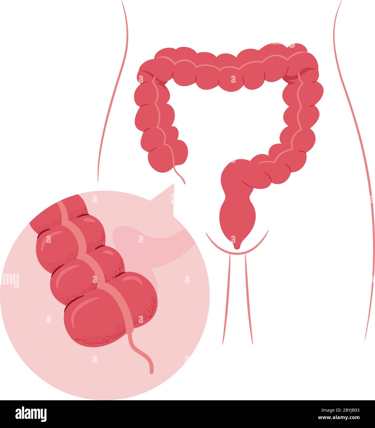 Illustrazione di un organo dell'intestino crasso con appendice ingrandita Foto Stock