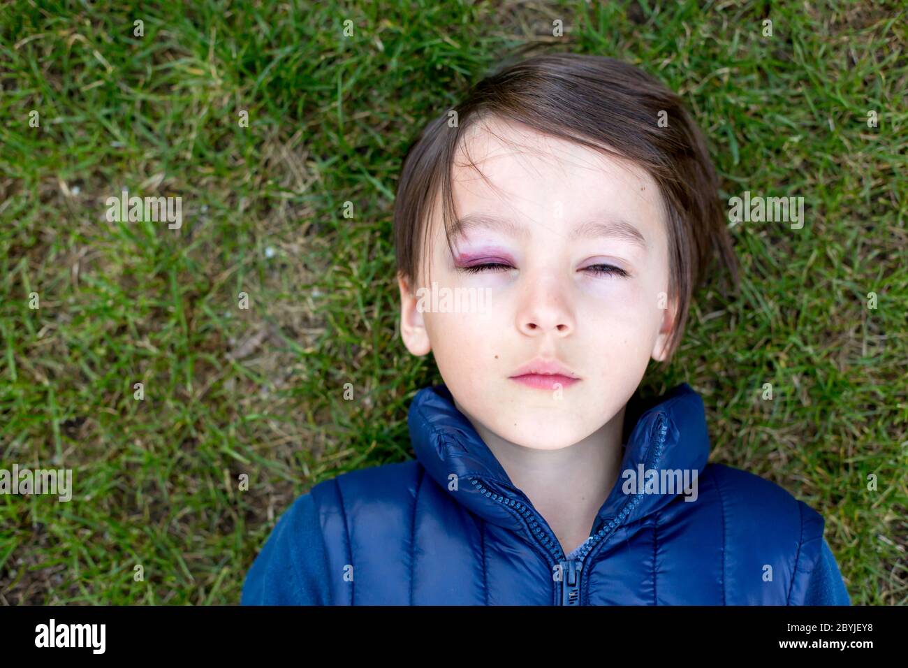 Triste ragazzo di scuola con occhio nero, bruisiness, abuso di bambino e ferita Foto Stock