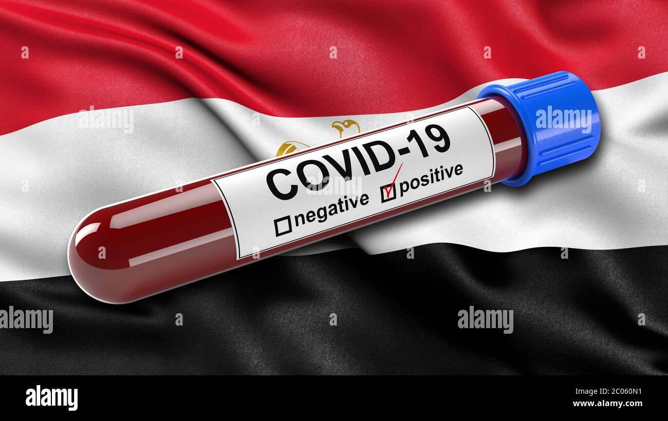 Bandiera egiziana che svela nel vento con una provetta per analisi del sangue COVID-19 positiva, concetto di illustrazione 3D per gli esami del sangue per diagnosticare il nuovo virus corona Foto Stock