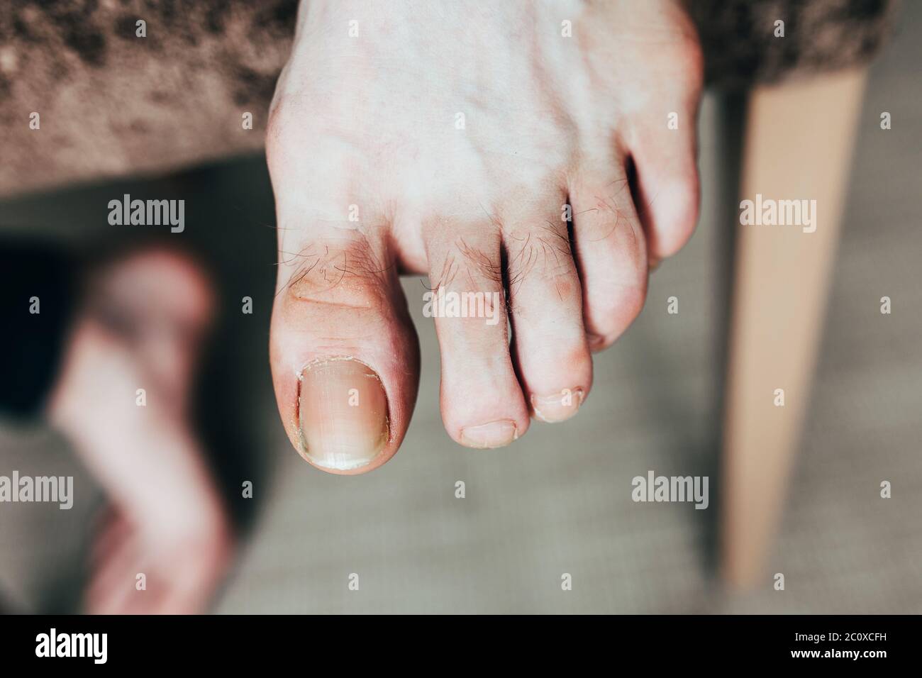 Pedicure del piede degli uomini prima del trattamento delle unghie - igiene personale - miniatura incrinata Foto Stock