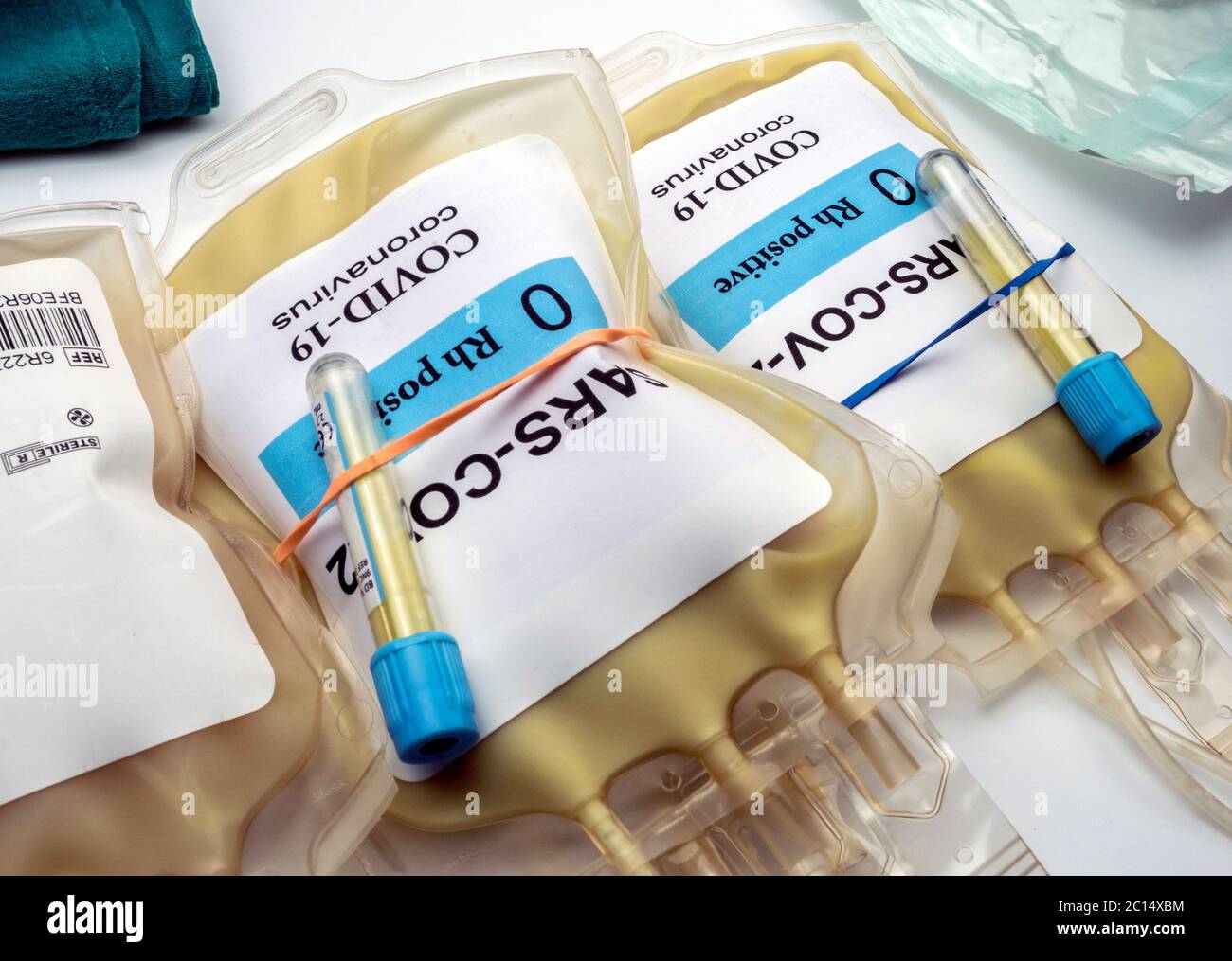 Sacca per plasma con anticorpi da persone curate di SARS-COV-2 Covid-19 preparata in un'immagine concettuale ospedaliera Foto Stock